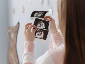 Casper Medical Imaging: Revolutionizing Patient Care Through Advanced Technology
